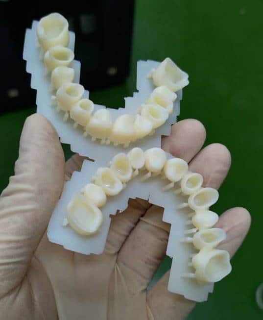 Phrozen Sonic: Dental 3D Printer ที่ราคาย่อมเยา ปริ้นไว